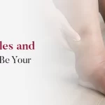 Swollen ankles and feet linked to possible kidney problems